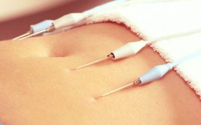 Curso de Eletroestética em Niterói – Matricule-se Já!